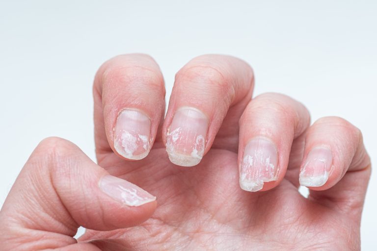 errores que destruyen tus uñas